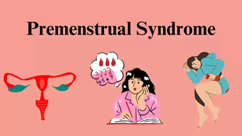 Do You have Premenstrual Syndrome?