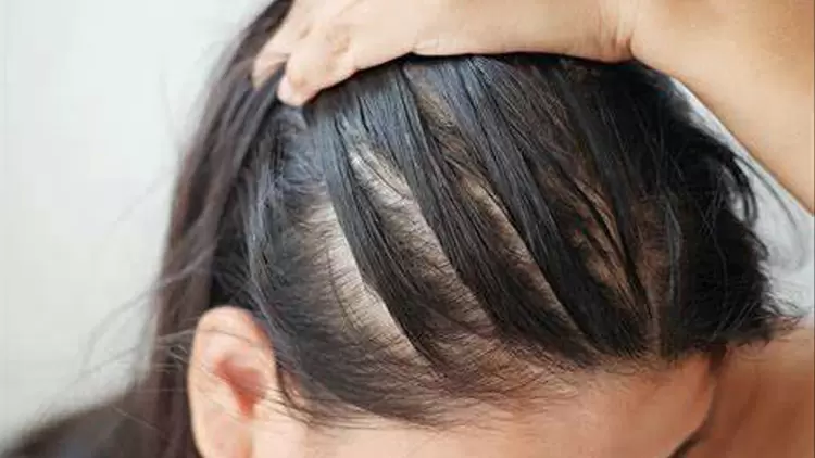 You will have some thinning hair in ten years. 